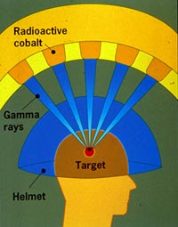 Gamma Knife